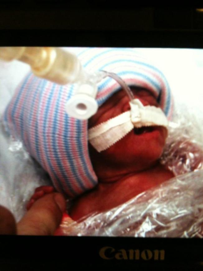 Born at 25 weeks, he is only 1lb 12oz